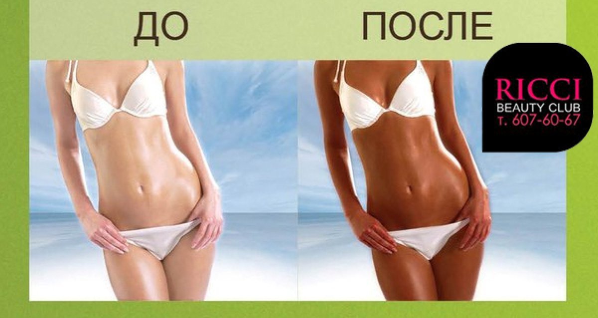 Что такое моментальный загар сколько держится Что такое моментальный загар сколько держится