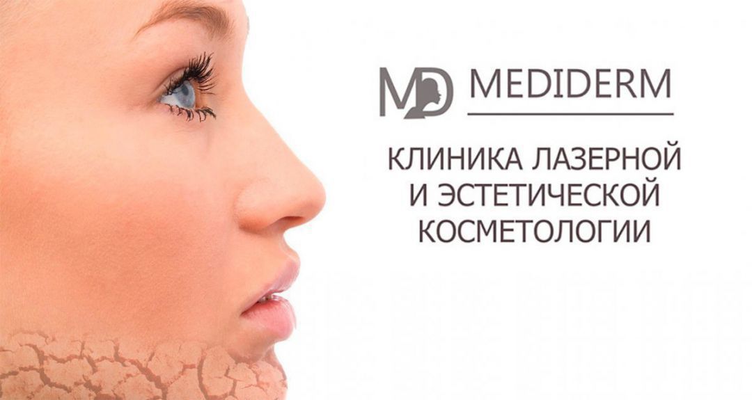 От 480 р. за удаление пигментных пятен и сосудов