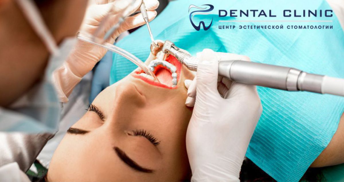 Скидки до 70% в стоматологии Dental Clinic на Оптиков