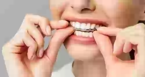 Как каппы исправляют зубы и кому они подойдут